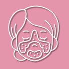 Rosacea